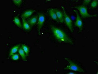 Glial fibrillary acidic protein antibody