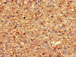 GFAP Antibody