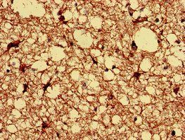 Glial fibrillary acidic protein antibody