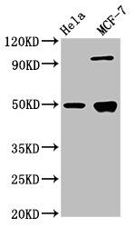 Glial fibrillary acidic protein antibody