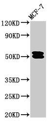 Glial fibrillary acidic protein antibody