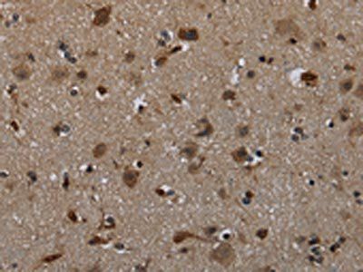 GLIPR1 Antibody