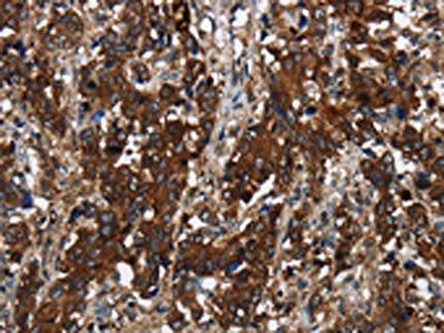 GLIPR1 Antibody