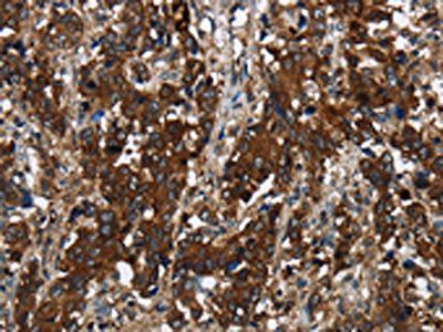 GLIPR1 antibody