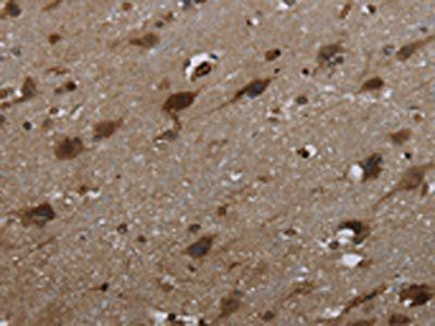 GLIPR1 Antibody