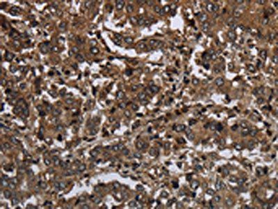 GLIPR1 Antibody