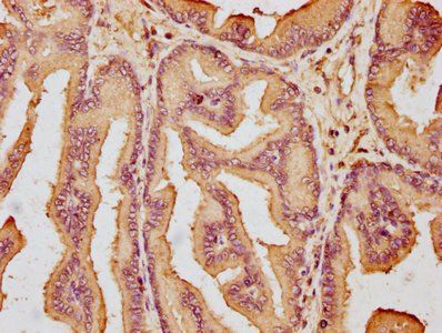 GLIPR2 Antibody