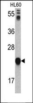 GLO1 antibody
