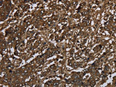 GLO1 Antibody