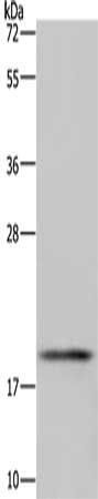 GLO1 Antibody