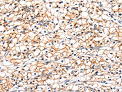 GLP1R Antibody