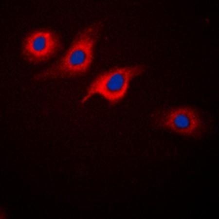 GLP-1 R antibody