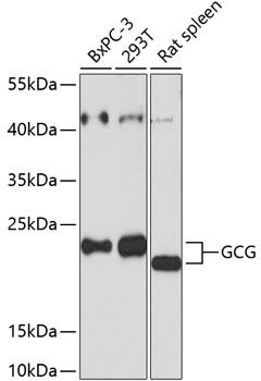GLP1 antibody