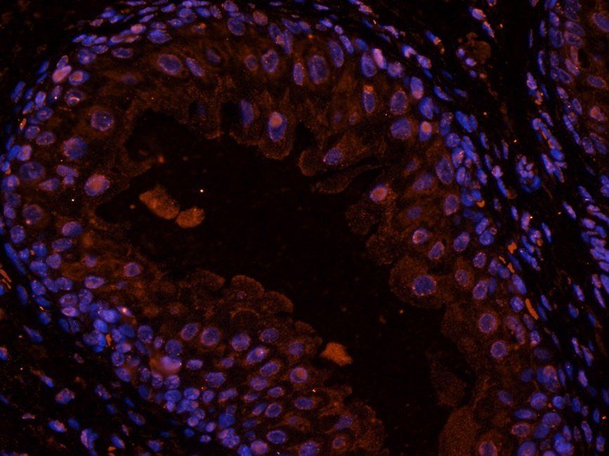 GLP2 antibody