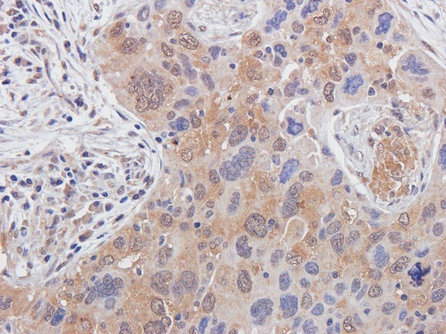 GLP2 antibody