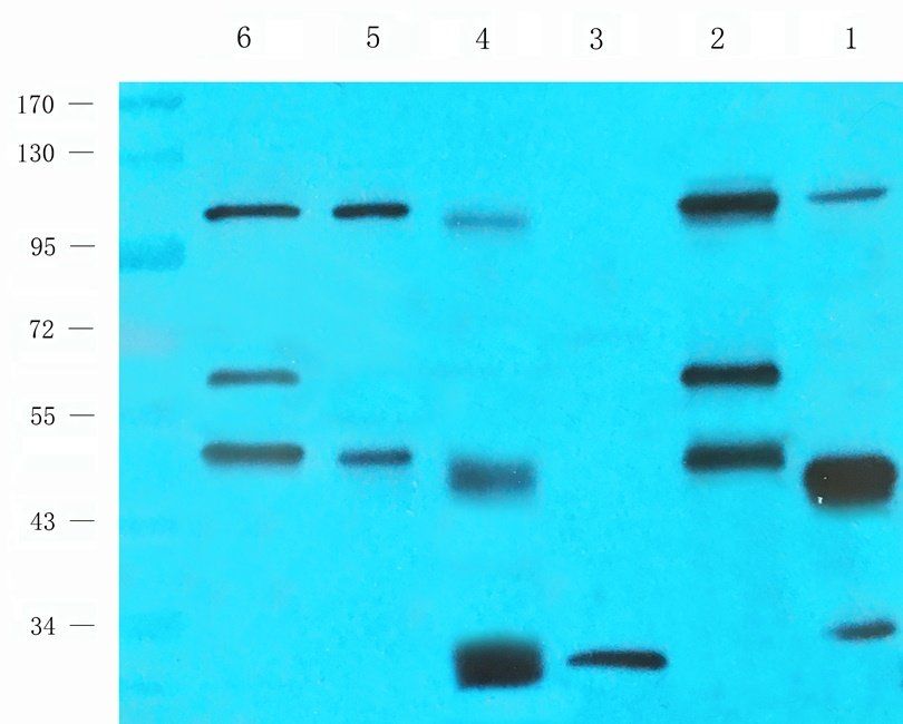 GLP2 antibody