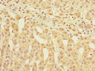 GLP2R Antibody