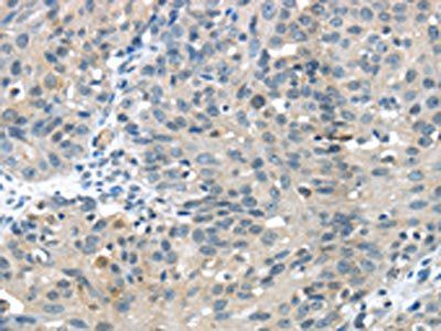 GLP2R Antibody