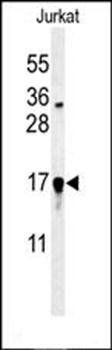 GLRX5 antibody