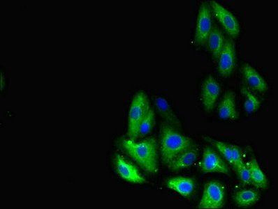 Glucagon-like peptide 1 R antibody