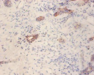 GLP1R Antibody
