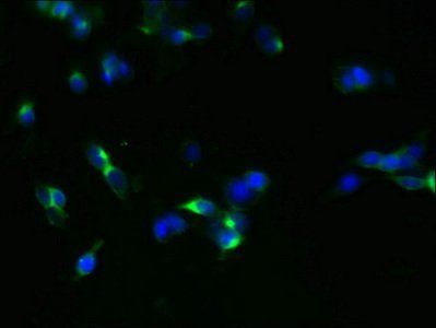 Glucagon-like peptide 1 R antibody