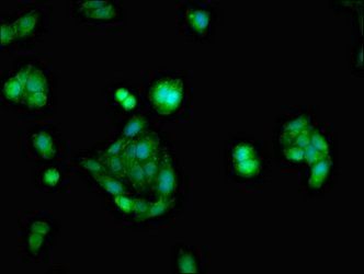 NR3C1 Antibody