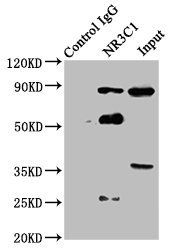 Glucocorticoid Receptor antibody