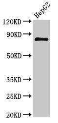 Glucocorticoid Receptor antibody