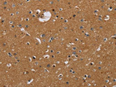 NR3C1 Antibody