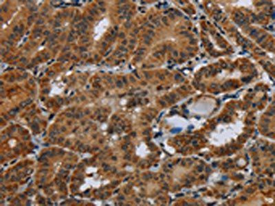 NR3C1 Antibody