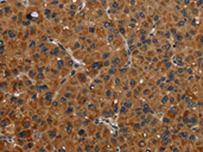 NR3C1 Antibody