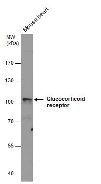 Glucocorticoid Receptor antibody