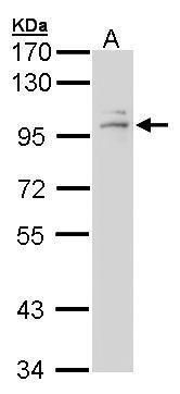 Glucocorticoid Receptor antibody