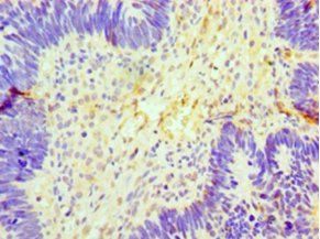 GCKR Antibody