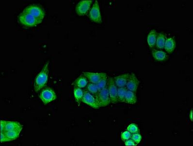 Glucose-6-phosphate isomerase antibody