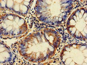 Glucose-6-phosphate isomerase antibody