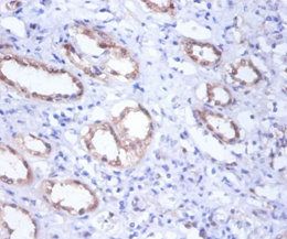 GPI Antibody