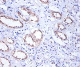 Glucose-6-phosphate isomerase antibody