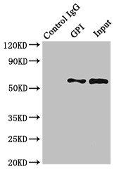 Glucose-6-phosphate isomerase antibody