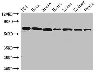 Glucose-6-phosphate isomerase antibody