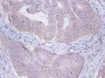 PRKCSH Antibody