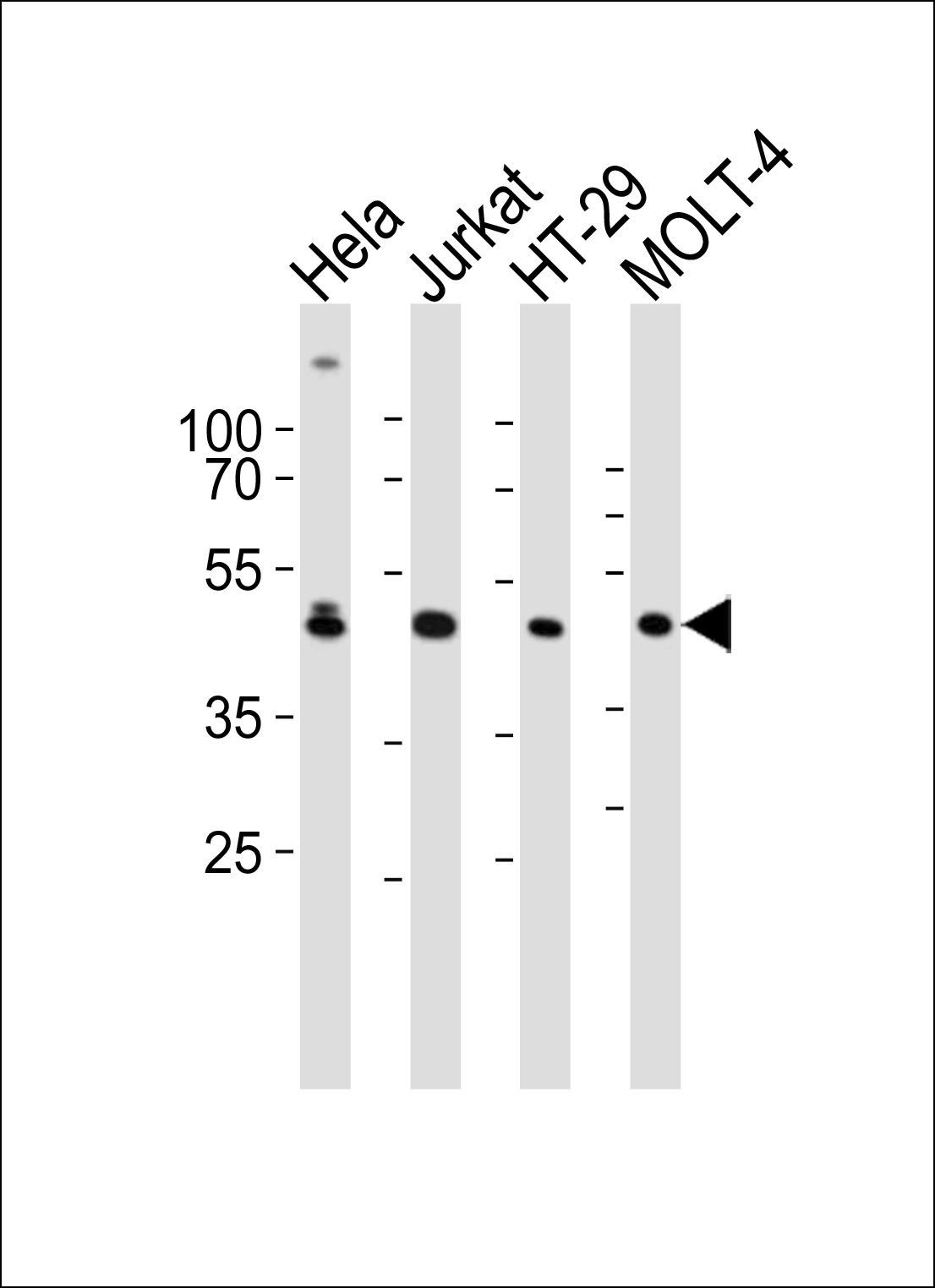 GLUL antibody