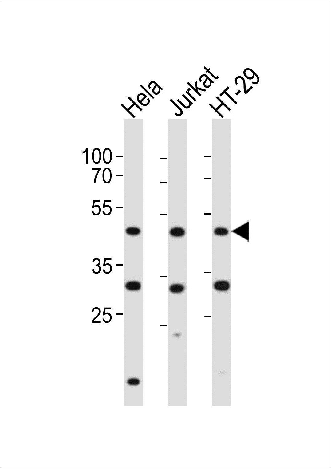 GLUL antibody