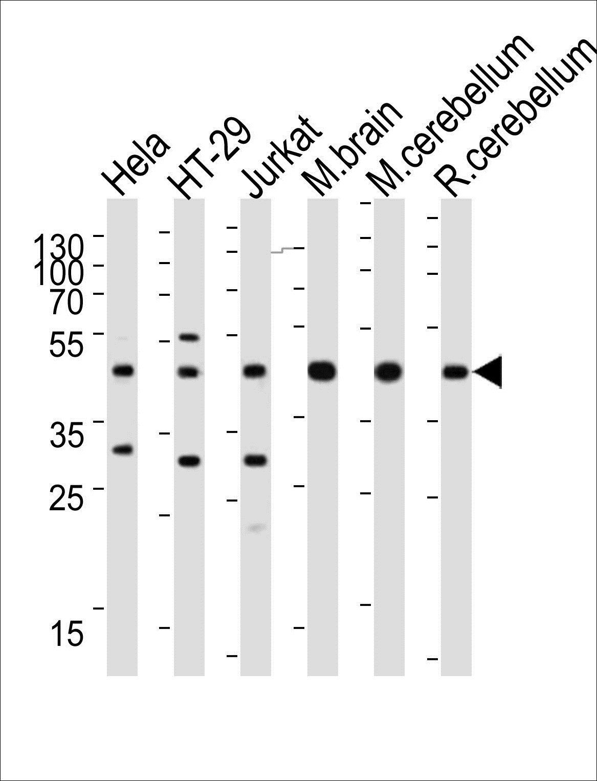 GLUL Antibody (N-term)