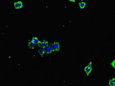 GLUL Antibody