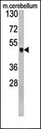 GLUL Antibody (N-term)