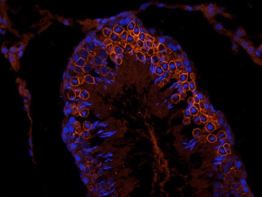 GLUT3 antibody