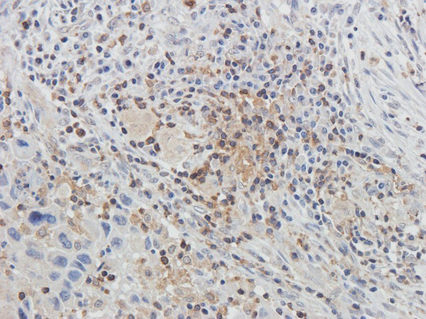 GLUT3 antibody