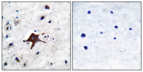GLUT3 Antibody